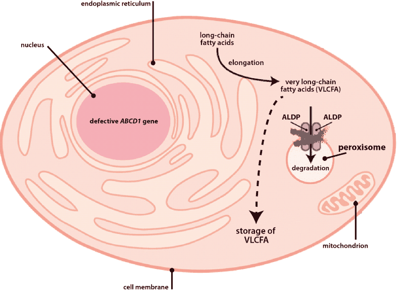 Understanding the ALD gene