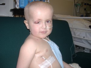 Poorly Lennon with black eye